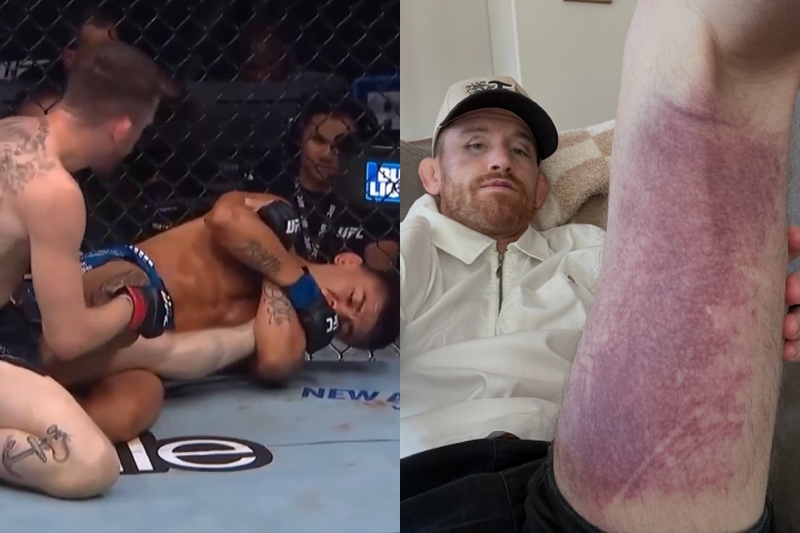 Cory Sandhagen's Kneebar Injury Is a Hard Lesson for BJJ